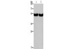 Gel: 8%SDS-PAGE, Lysate: 40 