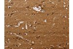 The image on the left is immunohistochemistry of paraffin-embedded Human brain tissue using CSB-PA240124(ELAVL2 Antibody) at dilution 1/40, on the right is treated with synthetic peptide. (Original magnification: 