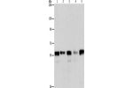 Gel: 8%SDS-PAGE, Lysate: 40 