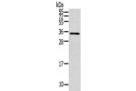 Gel: 12%SDS-PAGE,Lysate: 40 