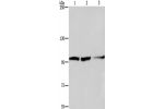 Gel: 6%SDS-PAGE,Lysate: 40 
