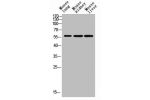Western blot analysis of mouse-lung mouse-brain mouse-heart Hela mouse-liver lysate, antibody was diluted at 500. Secondary antibody  was diluted at 1:20000