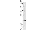 Gel: 8%SDS-PAGE, Lysate: 40 