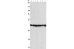 Gel: 10%SDS-PAGE, Lysate: 40 