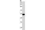 Gel: 10%SDS-PAGE, Lysate: 40 