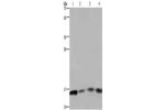 Gel: 10%SDS-PAGE, Lysate: 40 