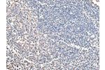 The image on the left is immunohistochemistry of paraffin-embedded Human tonsil tissue using CSB-PA246804(COX4I1 Antibody) at dilution 1/20, on the right is treated with synthetic peptide. (Original magnification: 