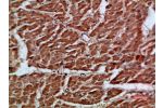 Immunohistochemical analysis of paraffin-embedded human-heart, antibody was diluted at 1:200