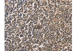 The image on the left is immunohistochemistry of paraffin-embedded Human tonsil tissue using CSB-PA248125(DRG1 Antibody) at dilution 1/20, on the right is treated with fusion protein. (Original magnification: 