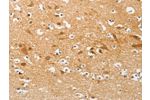 The image on the left is immunohistochemistry of paraffin-embedded Human brain tissue using CSB-PA248529(AP2M1 Antibody) at dilution 1/20, on the right is treated with fusion protein. (Original magnification: 