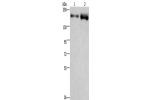 Gel: 8%SDS-PAGE, Lysate: 40 