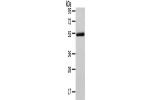 Gel: 8%SDS-PAGE, Lysate: 40 