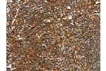 The image on the left is immunohistochemistry of paraffin-embedded Human tonsil tissue using CSB-PA254306(CNNM3 Antibody) at dilution 1/40, on the right is treated with fusion protein. (Original magnification: 