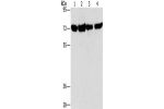 Gel: 6%SDS-PAGE, Lysate: 40 