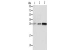 Gel: 12%SDS-PAGE, Lysate: 40 