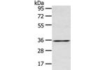 Gel: 10%SDS-PAGE, Lysate: 40 