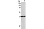 Gel: 8%SDS-PAGE, Lysate: 50 