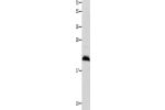 Gel: 12%SDS-PAGE, Lysate: 40 