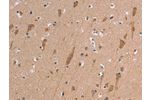 The image on the left is immunohistochemistry of paraffin-embedded Human brain tissue using CSB-PA267720(ETFB Antibody) at dilution 1/50, on the right is treated with synthetic peptide. (Original magnification: 