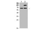 Western Blot analysis of 1,Hela 2,Mouse-kidney cells using primary antibody diluted at 1:2000(4