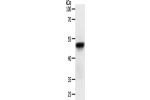Gel: 12%SDS-PAGE, Lysate: 50 