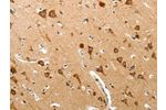 The image on the left is immunohistochemistry of paraffin-embedded Human brain tissue using CSB-PA271700(BIRC6 Antibody) at dilution 1/40, on the right is treated with synthetic peptide. (Original magnification: 