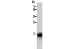Gel: 12%SDS-PAGE, Lysate: 40 