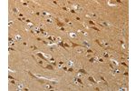 The image on the left is immunohistochemistry of paraffin-embedded Human brain tissue using CSB-PA274804(ATG4B Antibody) at dilution 1/50, on the right is treated with synthetic peptide. (Original magnification: 