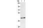 Gel: 8%SDS-PAGE, Lysate: 40 