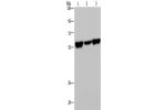 Gel: 8%SDS-PAGE, Lysate: 40 