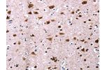 The image on the left is immunohistochemistry of paraffin-embedded Human brain tissue using CSB-PA276737(CSNK2A1 Antibody) at dilution 1/13, on the right is treated with fusion protein. (Original magnification: 