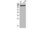 Western Blot analysis of 3T3 HEPG2 cells using Collagen alpha-1(XXVIII)Polyclonal Antibody diluted at 1:1000. Secondary antibody  was diluted at 1:20000