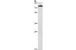 Gel: 8%SDS-PAGE, Lysate: 40 