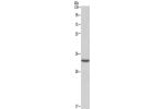 Gel: 8%SDS-PAGE, Lysate: 40 