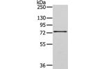 Gel: 6%SDS-PAGE, Lysate: 40 