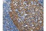 The image on the left is immunohistochemistry of paraffin-embedded Human tonsil tissue using CSB-PA283493(DCK Antibody) at dilution 1/20, on the right is treated with fusion protein. (Original magnification: 