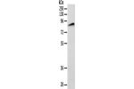 Gel: 10%SDS-PAGE, Lysate: 40 