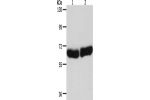 Gel: 8%SDS-PAGE, Lysate: 40 