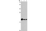 Gel: 15%SDS-PAGE, Lysate: 40 