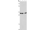 Gel: 10%SDS-PAGE, Lysate: 40 