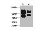 Western blot analysis of 1) Mouse Brain Tissue, 2)Rat Brain Tissue with GABA A Receptor ?2 Rabbit pAb diluted at 1:2,000.