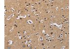 The image on the left is immunohistochemistry of paraffin-embedded Human brain tissue using CSB-PA290015(GNB5 Antibody) at dilution 1/20, on the right is treated with fusion protein. (Original magnification: 