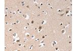 The image on the left is immunohistochemistry of paraffin-embedded Human brain tissue using CSB-PA291790(GCG(GLP1) Antibody) at dilution 1/20, on the right is treated with synthetic peptide. (Original magnification: 