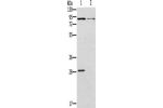 Gel: 8%SDS-PAGE, Lysate: 40 