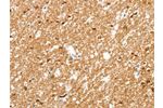 The image on the left is immunohistochemistry of paraffin-embedded Human brain tissue using CSB-PA292485(AMZ1 Antibody) at dilution 1/80, on the right is treated with synthetic peptide. (Original magnification: 