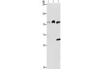 Gel: 6%SDS-PAGE, Lysate: 40 