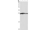 Gel: 12%SDS-PAGE, Lysate: 40 