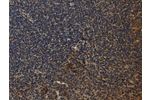 The image on the left is immunohistochemistry of paraffin-embedded Human tonsil tissue using CSB-PA299855(CYBA Antibody) at dilution 1/20, on the right is treated with synthetic peptide. (Original magnification: 