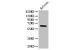Western Blot<br />
Positive WB detected in:mouse spleen tissue<br />
All lanes: GK antibody at 3ug/ml<br />
Secondary<br />
Goat polyclonal to rabbit IgG at 1/50000 dilution<br />
Predicted band size: 62,58,61,59 kDa<br />
Observed band size: 61 kDa<br />
