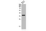 Western blot analysis of MOUSE-BRAIN lysis using ART1 antibody. Antibody was diluted at 1:2000. Secondary antibody  was diluted at 1:20000